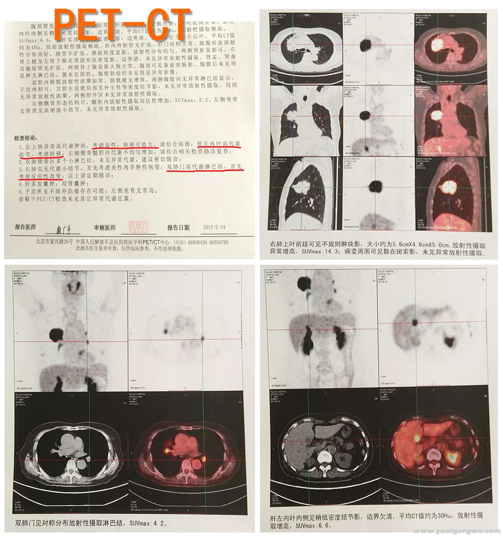 pet-ct汇总.jpg