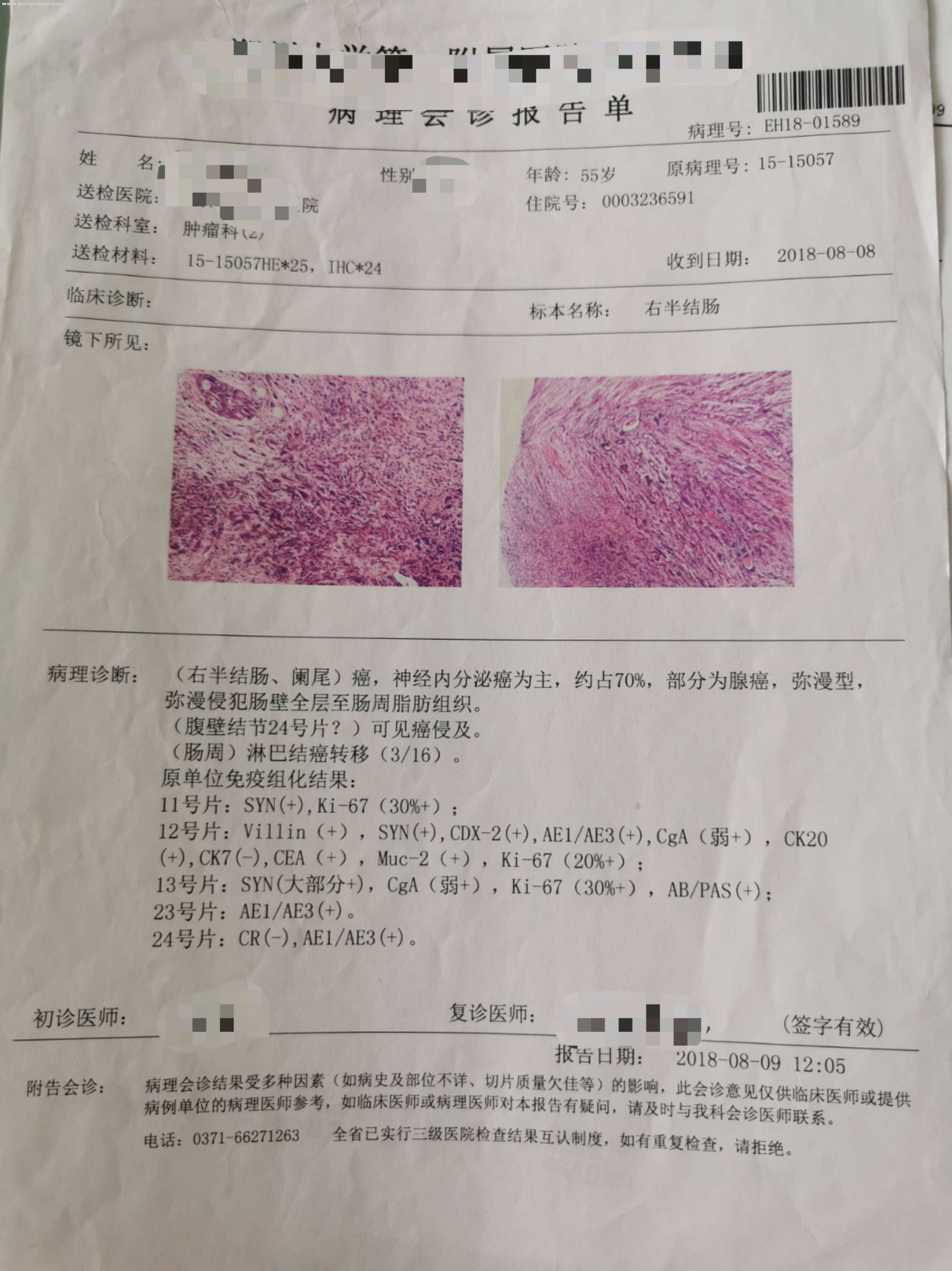 2018年病理报告