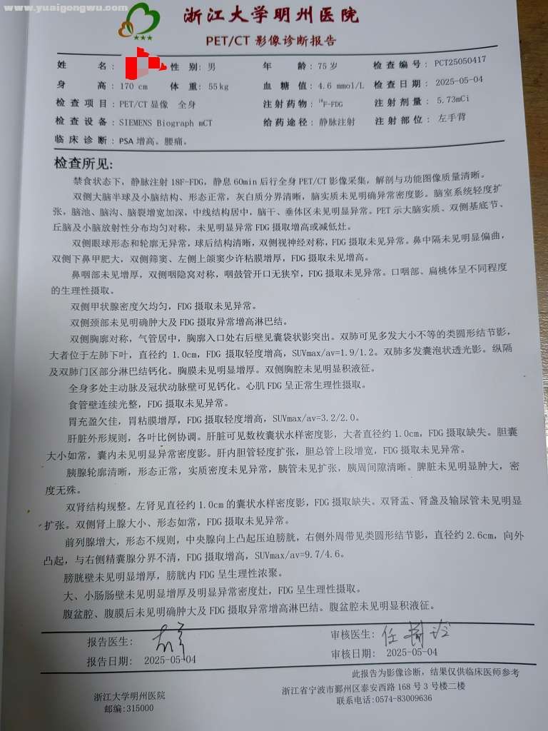 前列腺癌肺转骨转